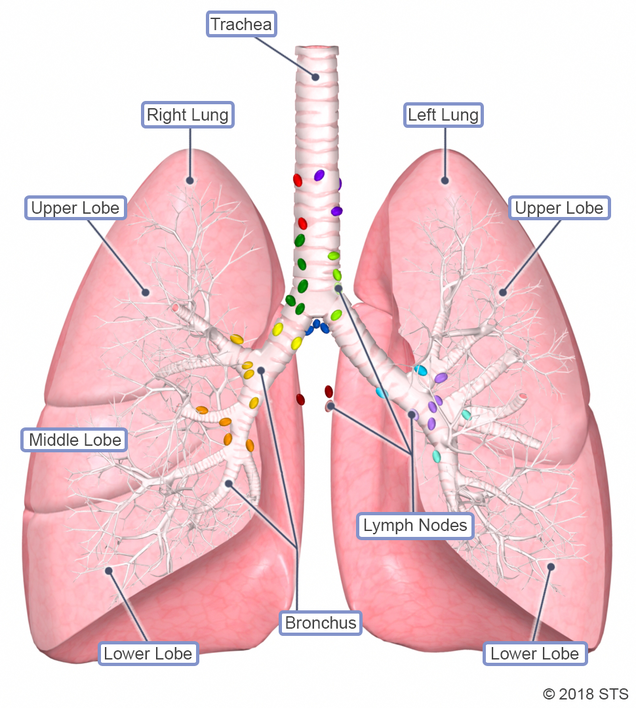how does malignant mesothelioma develop